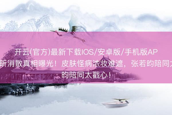 开云(官方)最新下载IOS/安卓版/手机版APP 唐艺昕消散真相曝光！皮肤怪病浓妆难遮，张若昀陪同太戳心！
